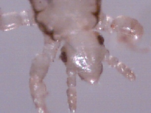 Image of  magnified head louse head